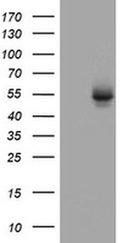 OXSM Monoclonal Antibody (OTI3A4), TrueMAB , OriGene 100 &mu;L | Buy Online | OriGene | Fisher Scientific