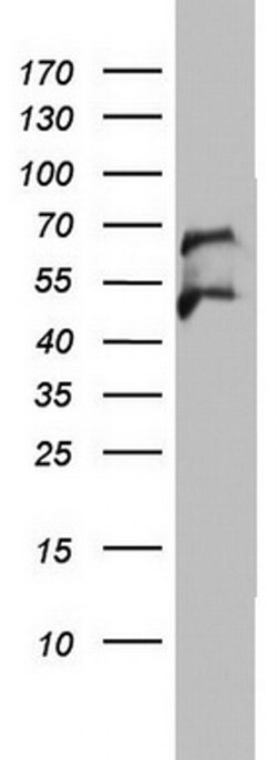 OXSM Monoclonal Antibody (OTI3A4), TrueMAB , OriGene 100 &mu;L | Buy Online | OriGene | Fisher Scientific