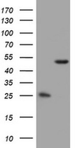 OXSM Monoclonal Antibody (OTI1H6), TrueMAB , OriGene 100 &mu;L; Unconjugated:Antibodies,