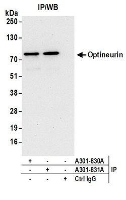 Optineurin Rabbit anti-Human, Polyclonal, Bethyl Laboratories 100 &mu;L;