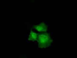 CDKN2A (p16INK4a) Mouse anti-Human, Clone: OTI4C11, liquid, TrueMAB 30