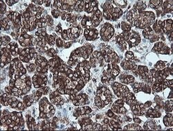 CDKN2A (p16INK4a) Mouse anti-Human, Clone: OTI4C11, liquid, TrueMAB 30