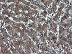 CDKN2A (p16INK4a) Mouse anti-Human, Clone: OTI4C11, liquid, TrueMAB 30