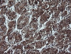 CDKN2A (p16INK4a) Mouse anti-Human, Clone: OTI4C11, liquid, TrueMAB 30