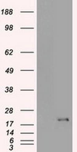 CDKN2A (p16INK4a) Mouse anti-Human, Clone: OTI4C11, liquid, TrueMAB 30