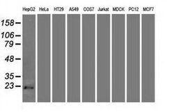 CDKN2A (p16INK4a) Mouse anti-Human, Clone: OTI4C11, liquid, TrueMAB 30
