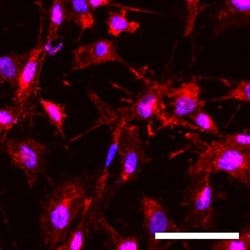Invitrogen P2Y12 Recombinant Rabbit Monoclonal Antibody (4H5L19) 100 &mu;g;