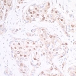 p300 Rabbit anti-Human, Polyclonal, Bethyl Laboratories 100 &mu;L; Unconjugated:Antibodies,