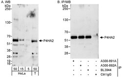 P4HA2 Rabbit anti-Human, Polyclonal, Bethyl Laboratories 100 &mu;L; Unconjugated:Antibodies,