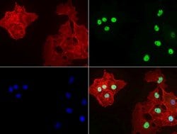 P53 Mouse anti-Human, Clone: UMAB62, lyophilized, UltraMAB 100 &mu;g; Unconjugated:Anticuerpos