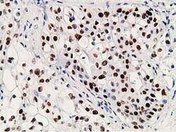 P53 Mouse anti-Human, Clone: UMAB18, liquid, UltraMAB 100 &mu;L; Unconjugated:Antibodies,