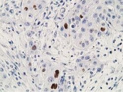 P53 Mouse anti-Human, Clone: UMAB18, liquid, UltraMAB 100 &mu;L; Unconjugated:Antibodies,
