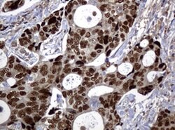 P53 Mouse anti-Human, Clone: UMAB62, lyophilized, UltraMAB 100 &mu;g; Unconjugated:Anticuerpos