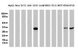 P53 Mouse anti-Human, Clone: UMAB62, lyophilized, UltraMAB 100 &mu;g; Unconjugated:Anticuerpos