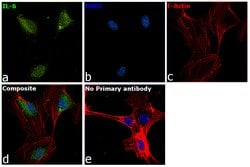 Invitrogen IL-6 Polyclonal Antibody 1 mg; Unconjugated:Antibodies, Polyclonal
