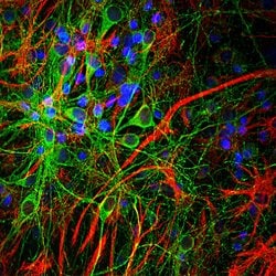 Invitrogen GFAP Polyclonal Antibody 100 &mu;L; Unconjugated:Antibodies,