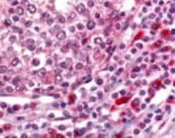 Invitrogen OGG1 Polyclonal Antibody 100 &mu;L; Unconjugated:Antibodies,