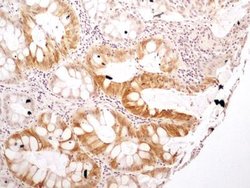 Invitrogen NTHL1 Polyclonal Antibody 200 &mu;L; Unconjugated:Antibodies,