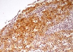Invitrogen NTHL1 Polyclonal Antibody 200 &mu;L; Unconjugated:Antibodies,
