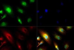 Invitrogen PER2 Polyclonal Antibody 100 &mu;L; Unconjugated:Antibodies,