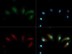 Invitrogen PHD2 Polyclonal Antibody 100 &mu;g; Unconjugated:Antibodies,