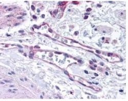 Invitrogen PHD2 Polyclonal Antibody 100 &mu;g; Unconjugated:Antibodies,