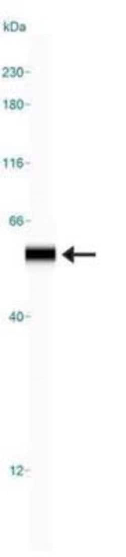 Invitrogen PHD2 Polyclonal Antibody 100 &mu;g; Unconjugated:Antibodies,