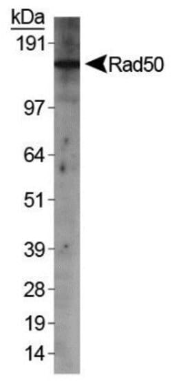 Invitrogen RAD50 Polyclonal Antibody 100 &mu;L | Buy Online | Invitrogen&trade; | Fisher Scientific