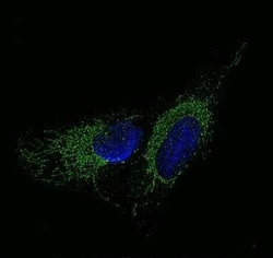 Invitrogen Aromatase Polyclonal Antibody 100 &mu;L; Unconjugated:Anticuerpos