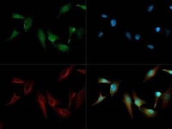 Invitrogen Cripto Polyclonal Antibody 100 &mu;L | Buy Online | Invitrogen&trade; | Fisher Scientific