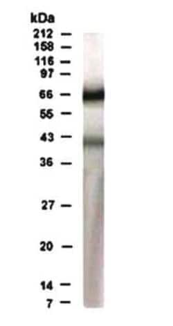 Invitrogen RAD17 Polyclonal Antibody 100 &mu;g | Buy Online | Invitrogen&trade; | Fisher Scientific