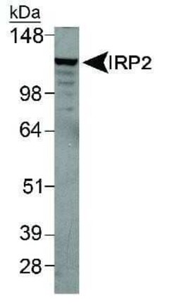 Invitrogen IREB2 Polyclonal Antibody 100 &mu;L | Buy Online | Invitrogen&trade; | Fisher Scientific