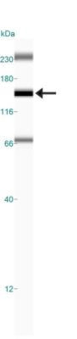Invitrogen FANCD2 Polyclonal Antibody 50 &mu;L; Unconjugated:Antibodies,