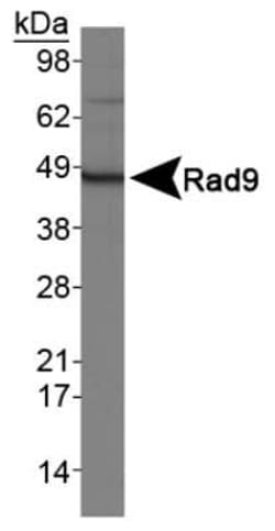 Invitrogen RAD9 Polyclonal Antibody 50 &mu;L | Buy Online | Invitrogen&trade; | Fisher Scientific