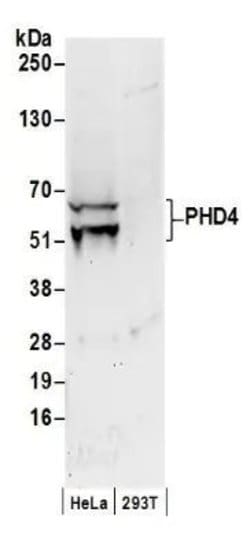 Invitrogen P4HTM Polyclonal Antibody 100 &mu;g; Unconjugated:Anticuerpos