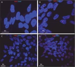 Invitrogen 53BP1 Polyclonal Antibody 100 &mu;L; Unconjugated:Anticuerpos