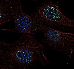 Invitrogen 53BP1 Polyclonal Antibody 100 &mu;L; Unconjugated:Anticuerpos