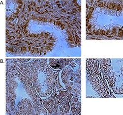Invitrogen 53BP1 Polyclonal Antibody 100 &mu;L; Unconjugated:Anticuerpos