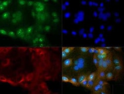 Invitrogen CYR61 Polyclonal Antibody 100 &mu;L; Unconjugated:Antibodies