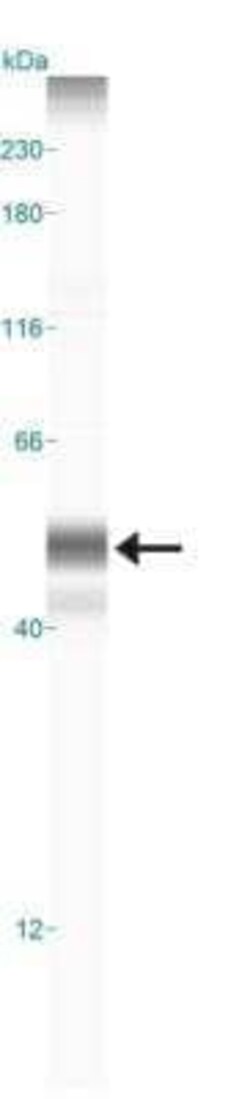 Invitrogen CYR61 Polyclonal Antibody 100 &mu;L; Unconjugated:Antibodies