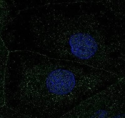 Invitrogen ATP7B Polyclonal Antibody 100 &mu;L; Unconjugated:Antibodies,