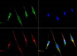 Invitrogen CTR1 Polyclonal Antibody 100 &mu;L | Buy Online | Invitrogen&trade; | Fisher Scientific