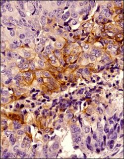 Invitrogen Carbonic Anhydrase IX Polyclonal Antibody 100 &mu;L; Unconjugated:Antibodies,