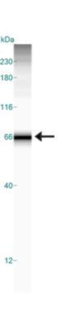 Invitrogen Carbonic Anhydrase IX Polyclonal Antibody 100 &mu;L; Unconjugated:Antibodies,