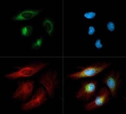 Invitrogen DERL1 Polyclonal Antibody 100 &mu;L; Unconjugated:Antibodies,