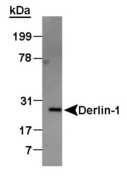 Invitrogen DERL1 Polyclonal Antibody 100 &mu;L; Unconjugated:Antibodies,
