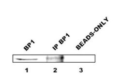 Invitrogen DLX4 Polyclonal Antibody 100 &mu;L; Unconjugated:Antibodies,