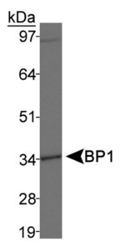 Invitrogen DLX4 Polyclonal Antibody 100 &mu;L; Unconjugated:Antibodies,