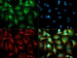 Invitrogen VEGF Receptor 1/2 Polyclonal Antibody 100 &mu;L; Unconjugated:Antibodies,