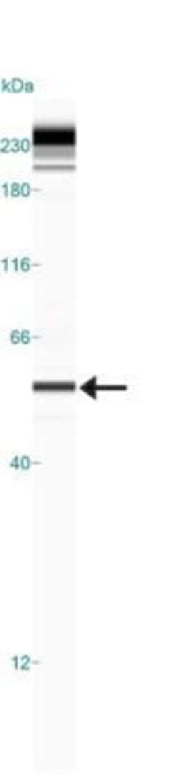 Invitrogen PINK1 Polyclonal Antibody 100 &mu;g | Buy Online | Invitrogen&trade; | Fisher Scientific